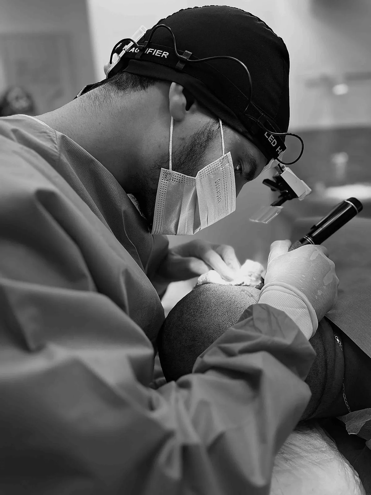 Dr. Thomaz Duca durante um transplante capilar