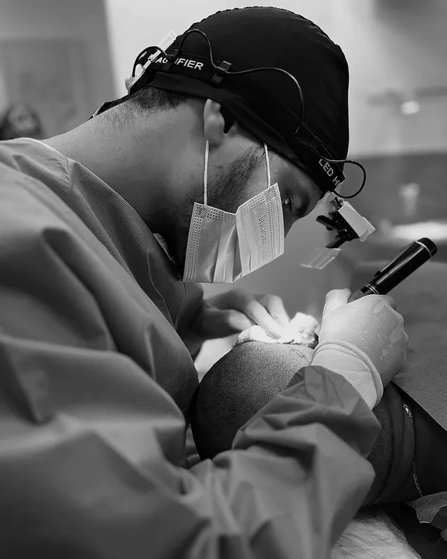 Dr. Thomaz Duca durante um transplante capilar