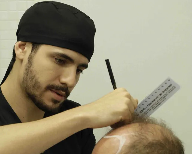 Dr. Thomaz Duca desenhando a linha do cabelo de um paciente