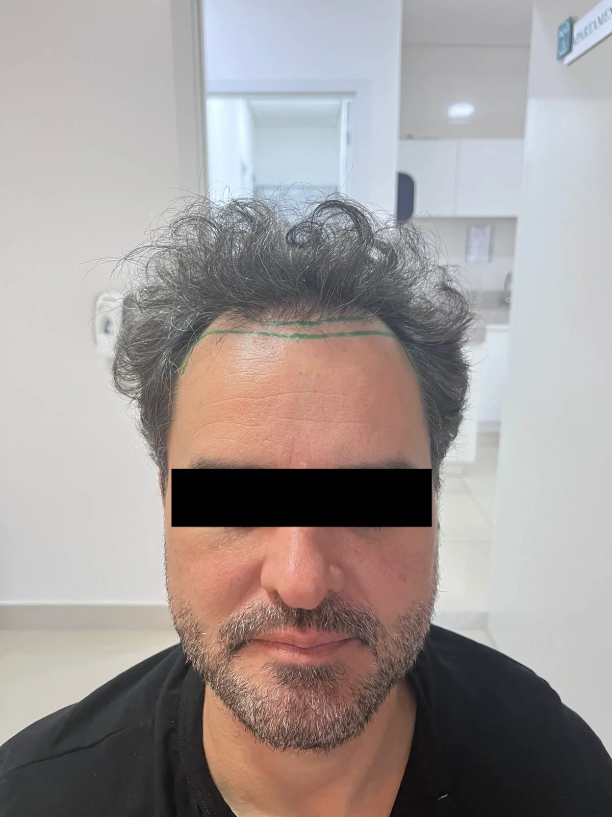 Antes